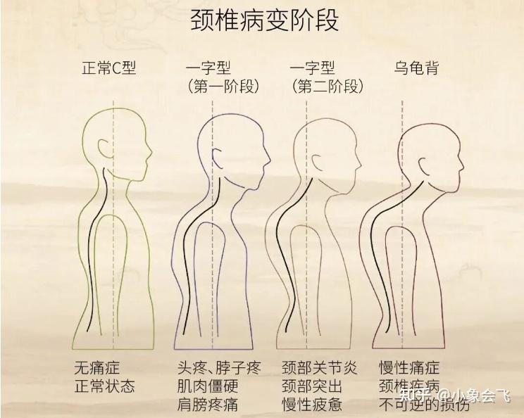 脖子和肩膀酸疼如何缓解？2026年肩颈按摩仪推荐！西屋揉捶按摩仪UK6S实测体验！久坐党、低头族的福音来了！