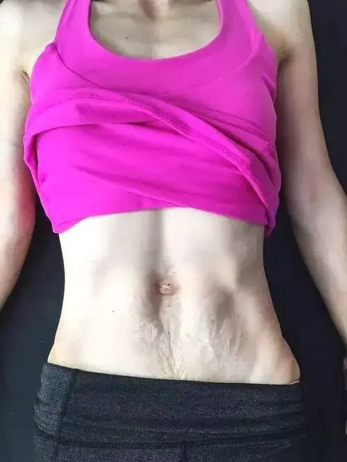 强效瘦紧小肚子,1小时快速减掉收紧腹部赘肉!