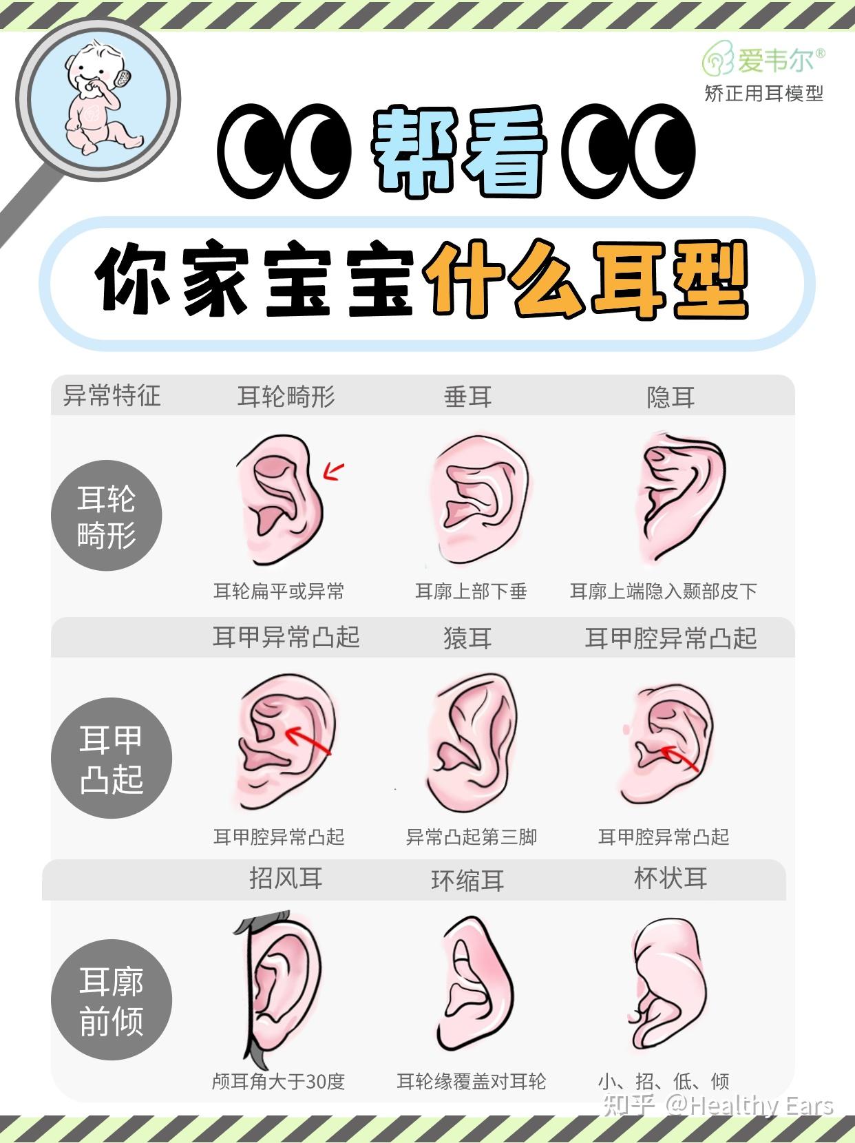 你家宝宝耳朵是什么形态?