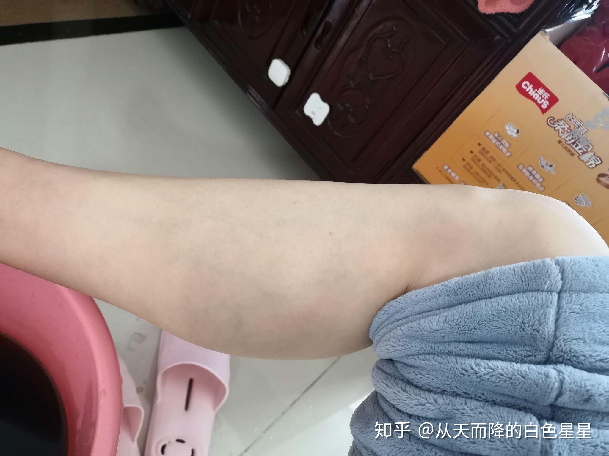 女生肌肉型小腿是什么体验