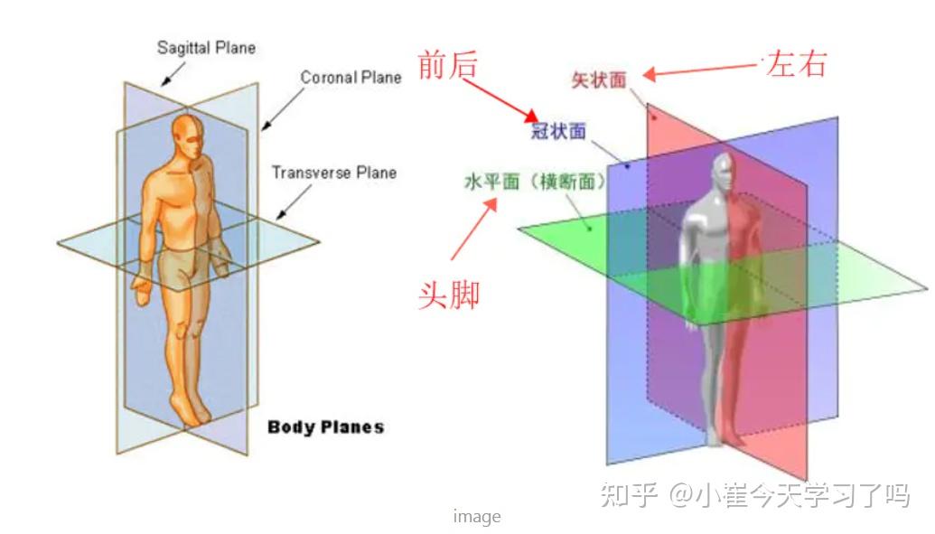 医学图像中横截面、冠状面、矢状面 - 知乎