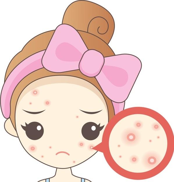 闭口粉刺该怎么消除愁死了