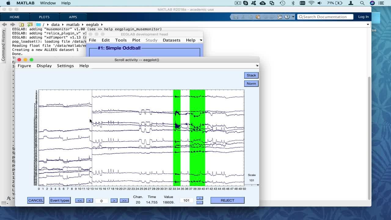 EEGLAB脑电数据预处理(视频版)