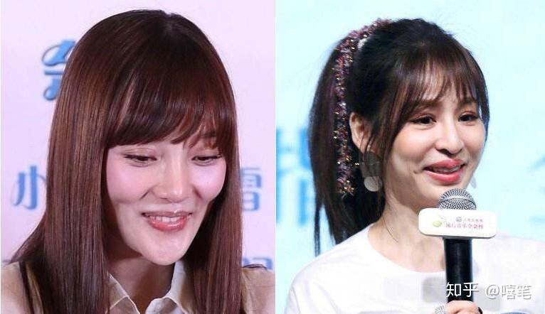 苹果肌太大了该如何是好