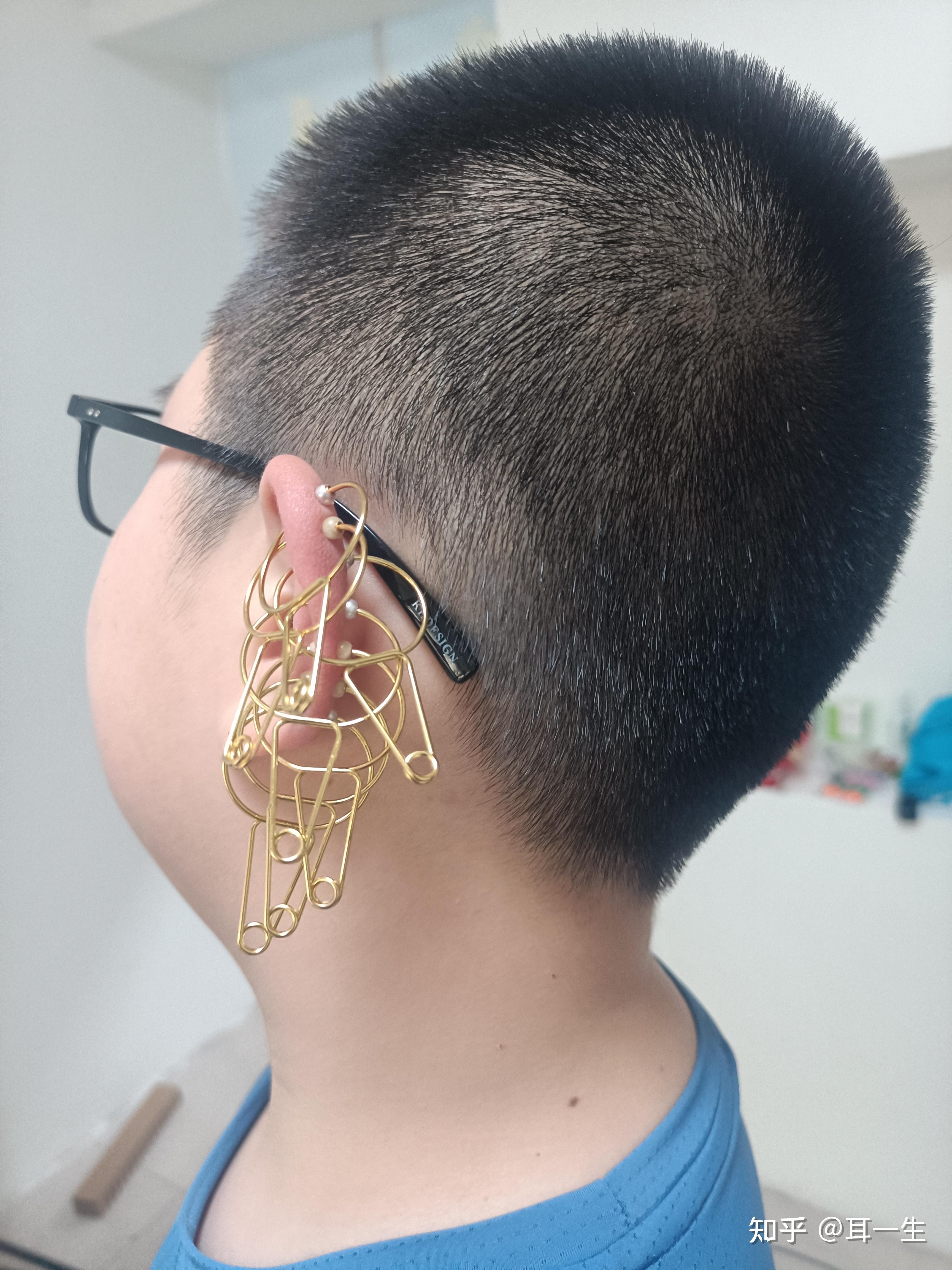 怕针的人适合做中医调理吗? - 知乎