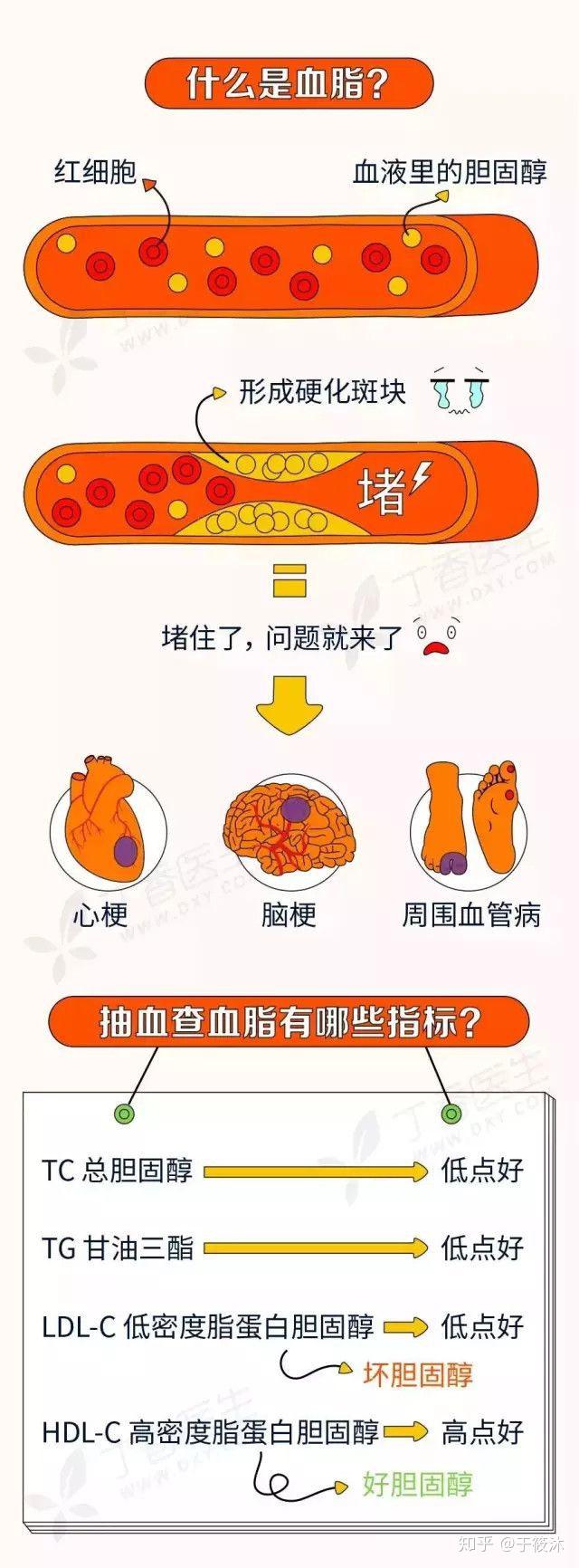血脂高怎么办? - 知乎