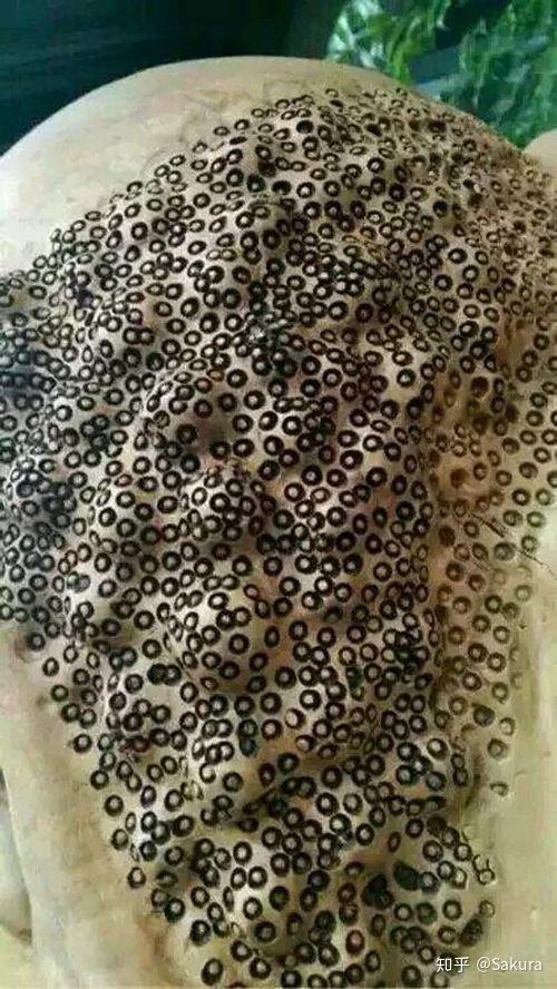 有哪些逼死密集恐惧症的图片或视频? - 知乎