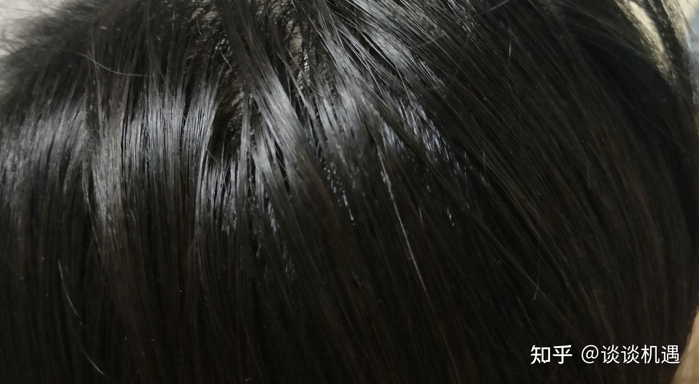 洗完头发之后发现以头顶为中心的一片区域黏黏的,硬硬的,像喷了啫喱水