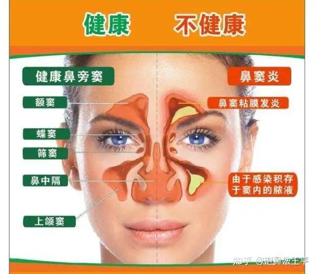 鼻窦结构功能再认识 - 知乎