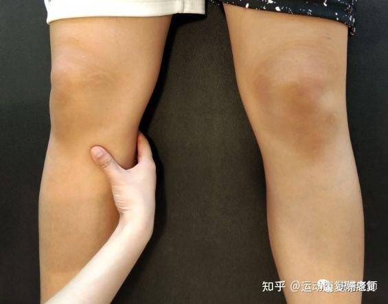跑完步膝盖内侧痛怎么办