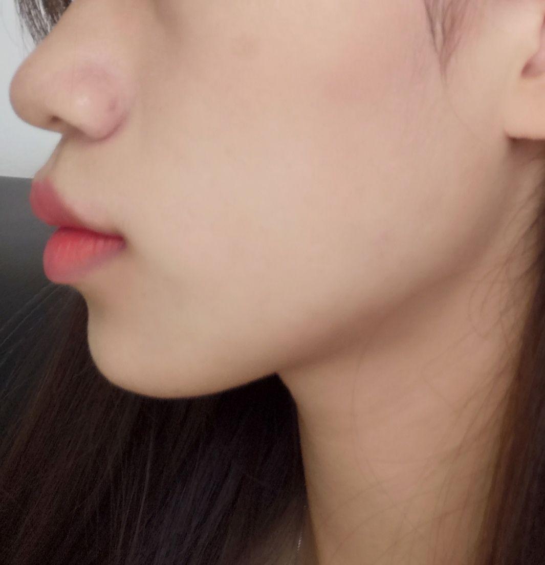 嘴唇厚且翘是什么体验? - 知乎