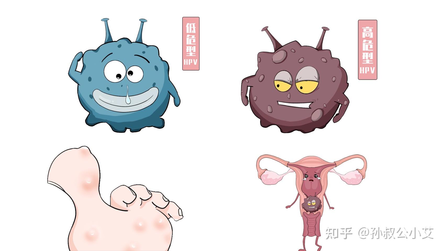 男性真的有必要打 hpv 疫苗吗? - 知乎