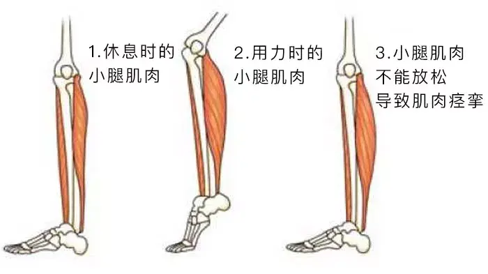 为什么睡觉时腿脚会突然抽筋