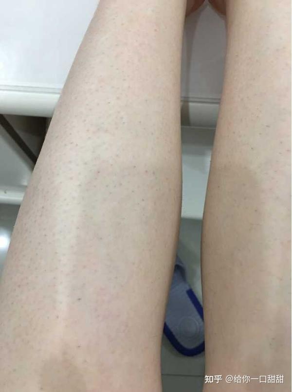永久不长毛?开水烫猪皮了解一下呢亲亲?