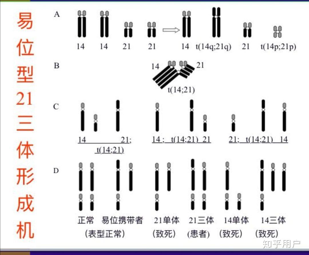 罗伯逊易位如何产生配子