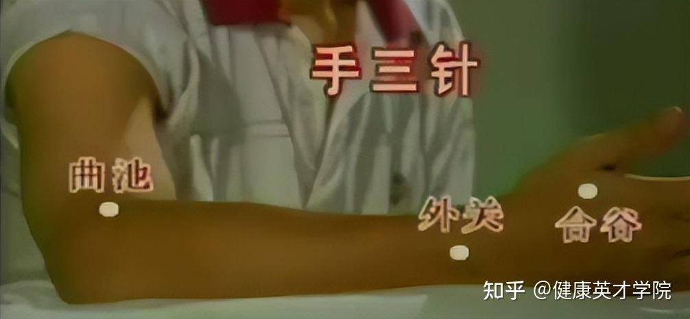 带你了解中医针灸“靳三针”疗法：三针秒杀绝技！ - 知乎