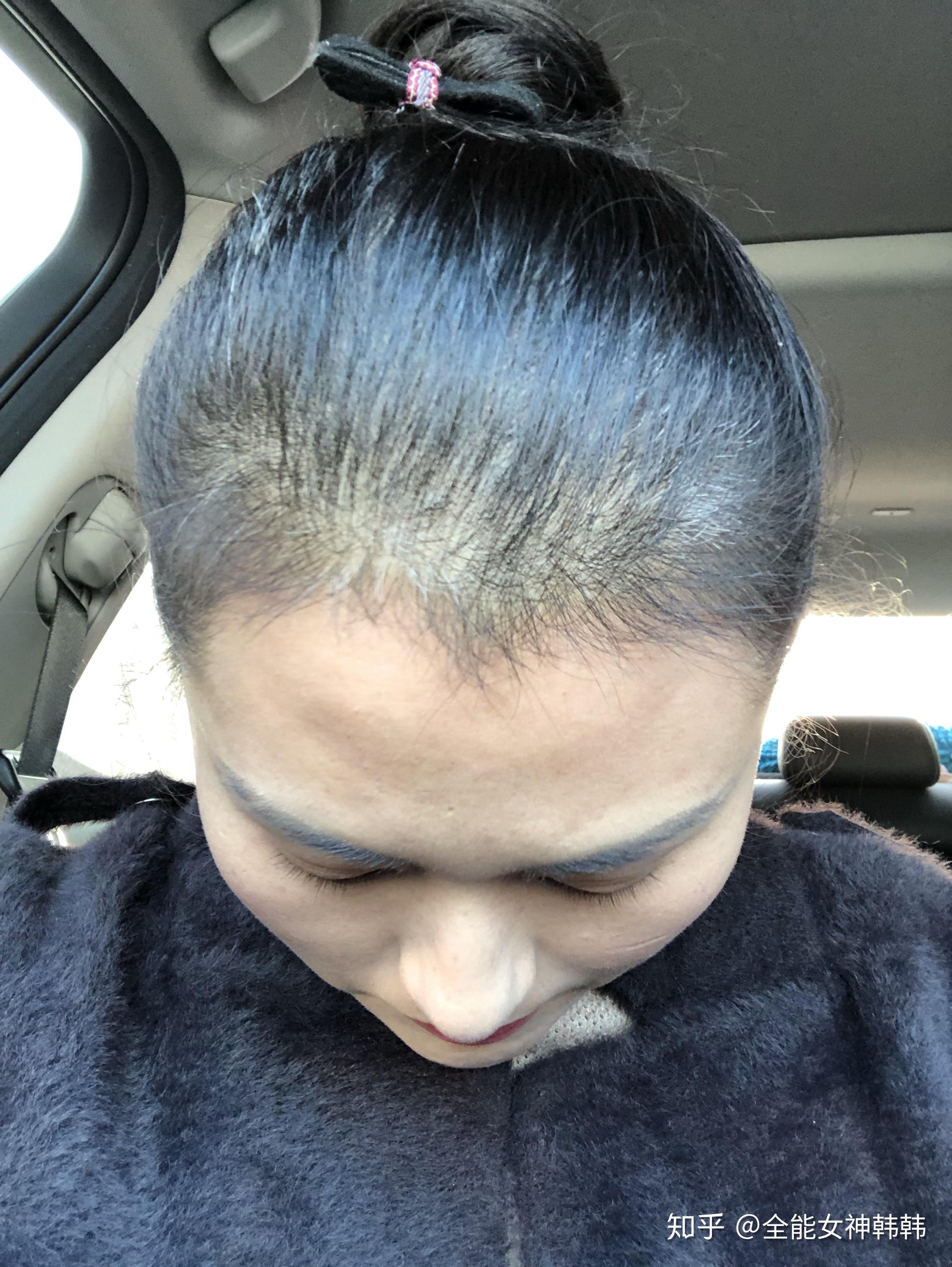 作为女生你是怎样秃的|11ω11)? - 知乎