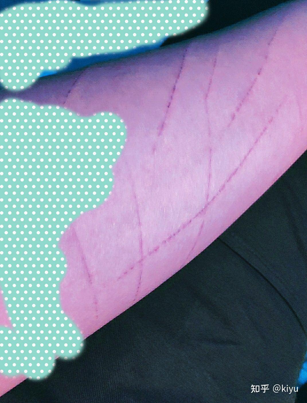 请问用美工刀划手臂自残的人,多久可以改变习惯? - 知乎