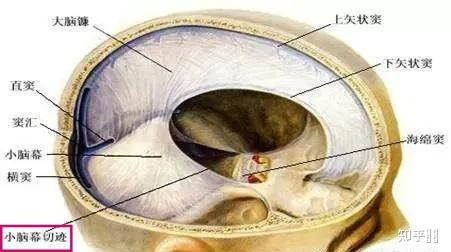 请问什么叫做"切迹"?