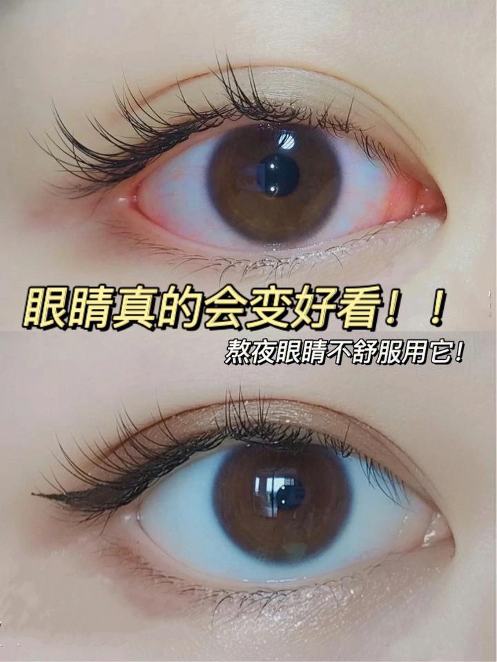 保护视力可太重要了,这份护眼攻略请收下 - 知乎