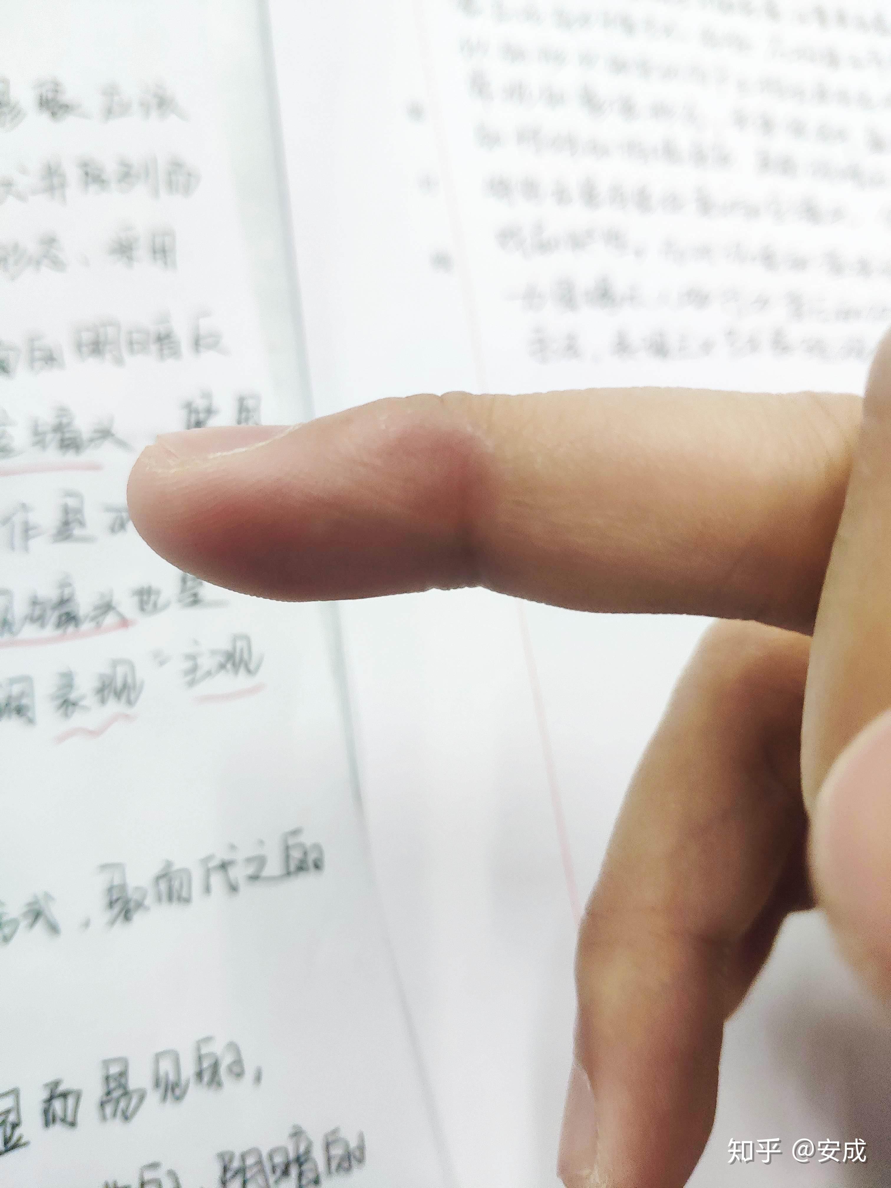 写字写久了是手腕疼还是手指疼在正确的握笔姿势的情况下还是握笔正确