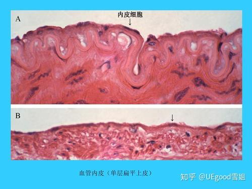 组胚红蓝铅笔实验图的单层扁平上皮和假复层纤毛柱状上皮怎么画呀?