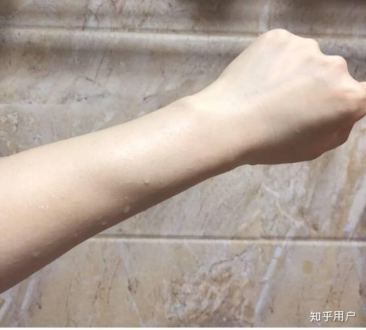 手臂特别黑是怎么回事怎么也养不白啊