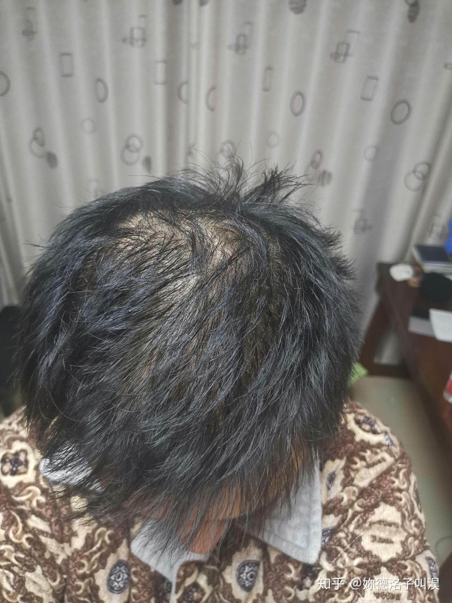 关注问题 67 写回答 登录/注册 发型 发型设计师 男士发型 头发