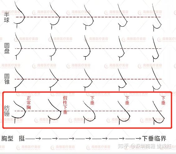 为什么网络上的大胸妹不下垂,我老婆才80d就下垂 纺锤胸 ? - 知乎