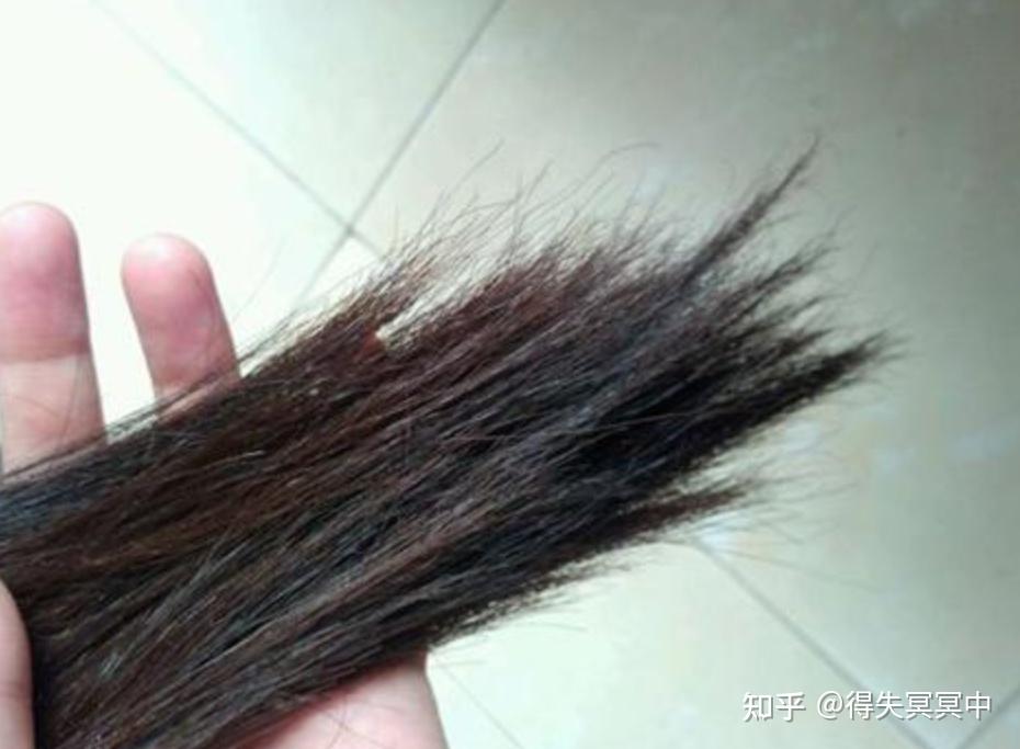 头发分叉的原因是什么