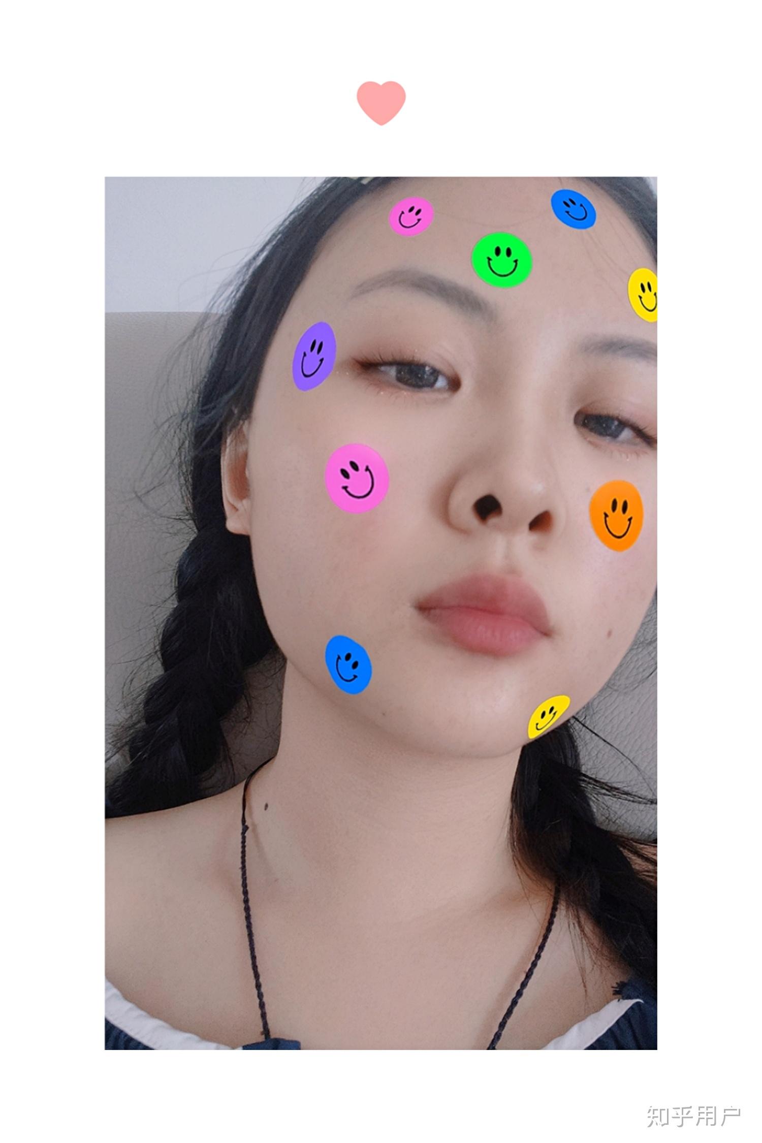 耳朵上端是尖的像精灵一样,是反古现象吗? - 知乎