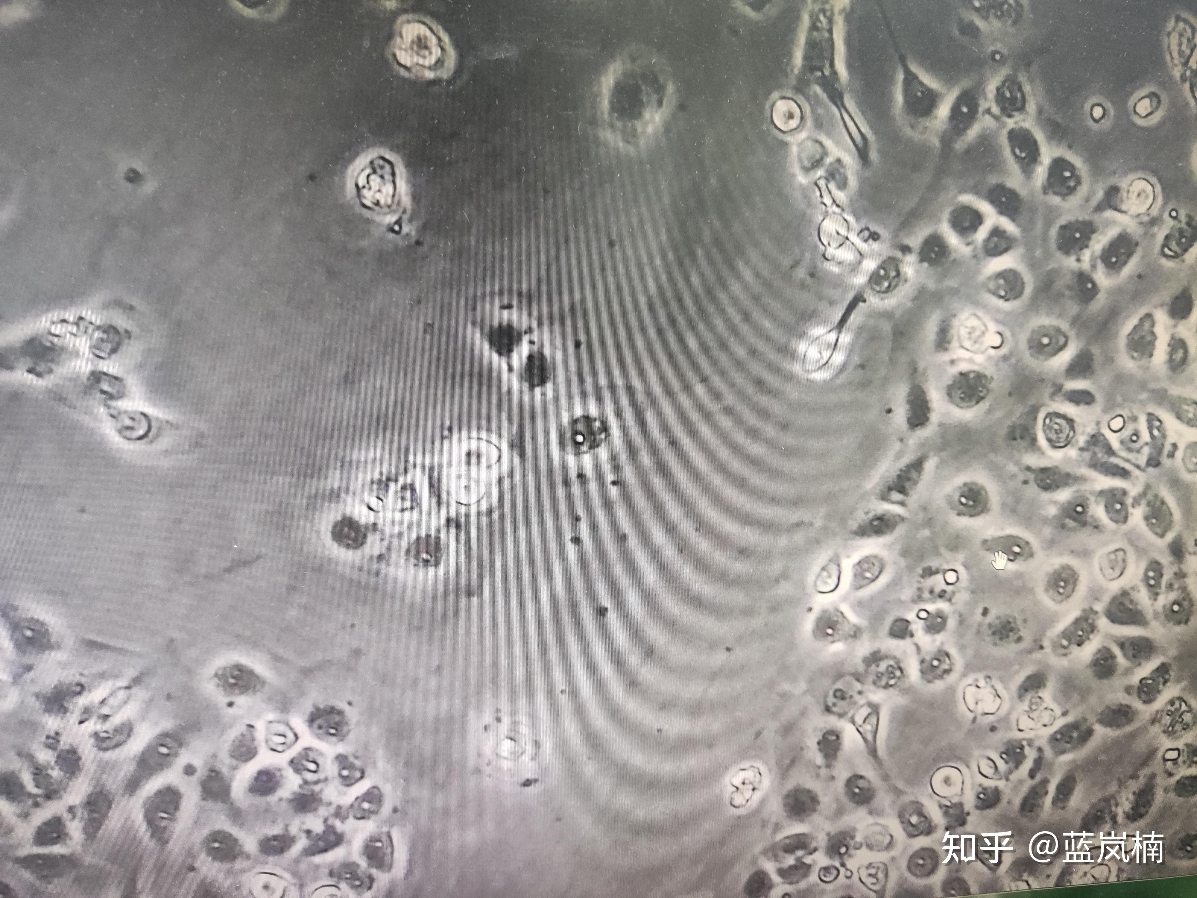 你在做实验过程中见过黑胶虫吗?是如何处理的? - 知乎