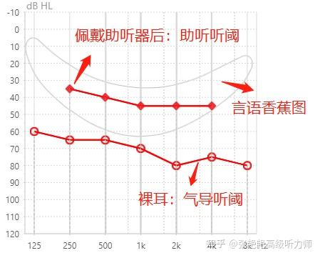 助听器效果到底怎样？4大评估方法，可以直接看“效果” - 知乎