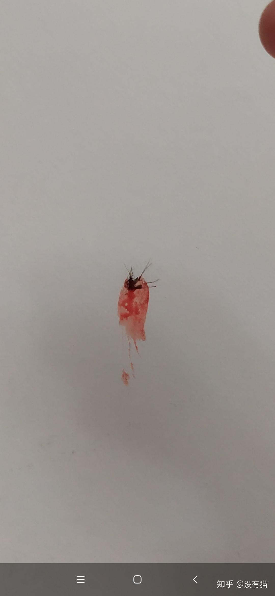 在墙上拍死蚊子后,墙上的血迹有没有什么好的处理方法? - 知乎