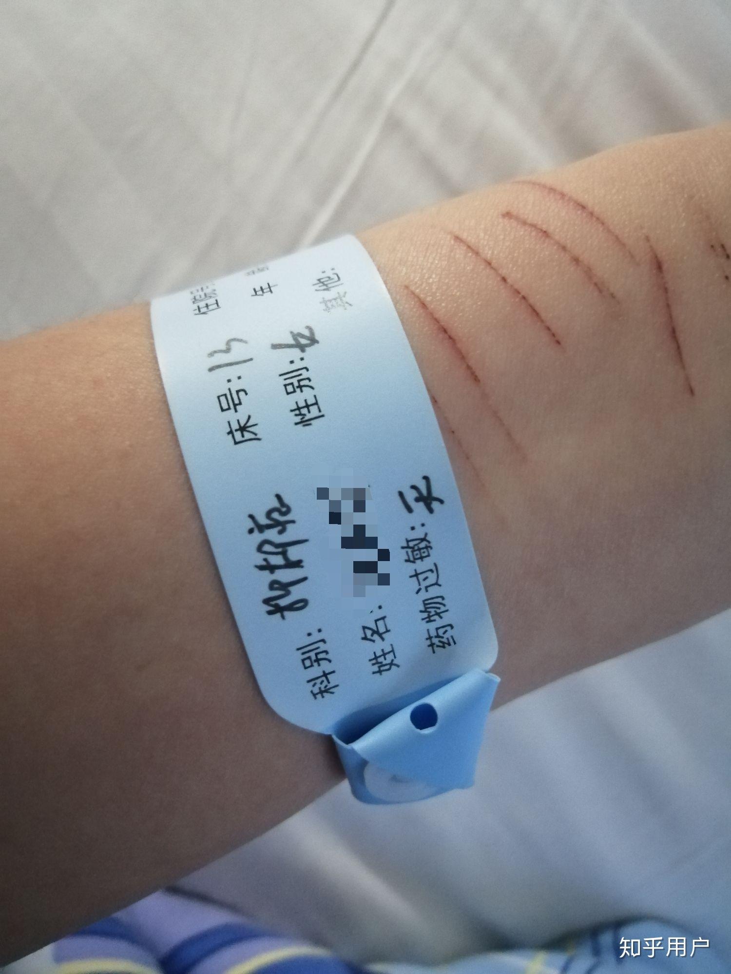 重度抑郁症患者会真的觉得快乐吗