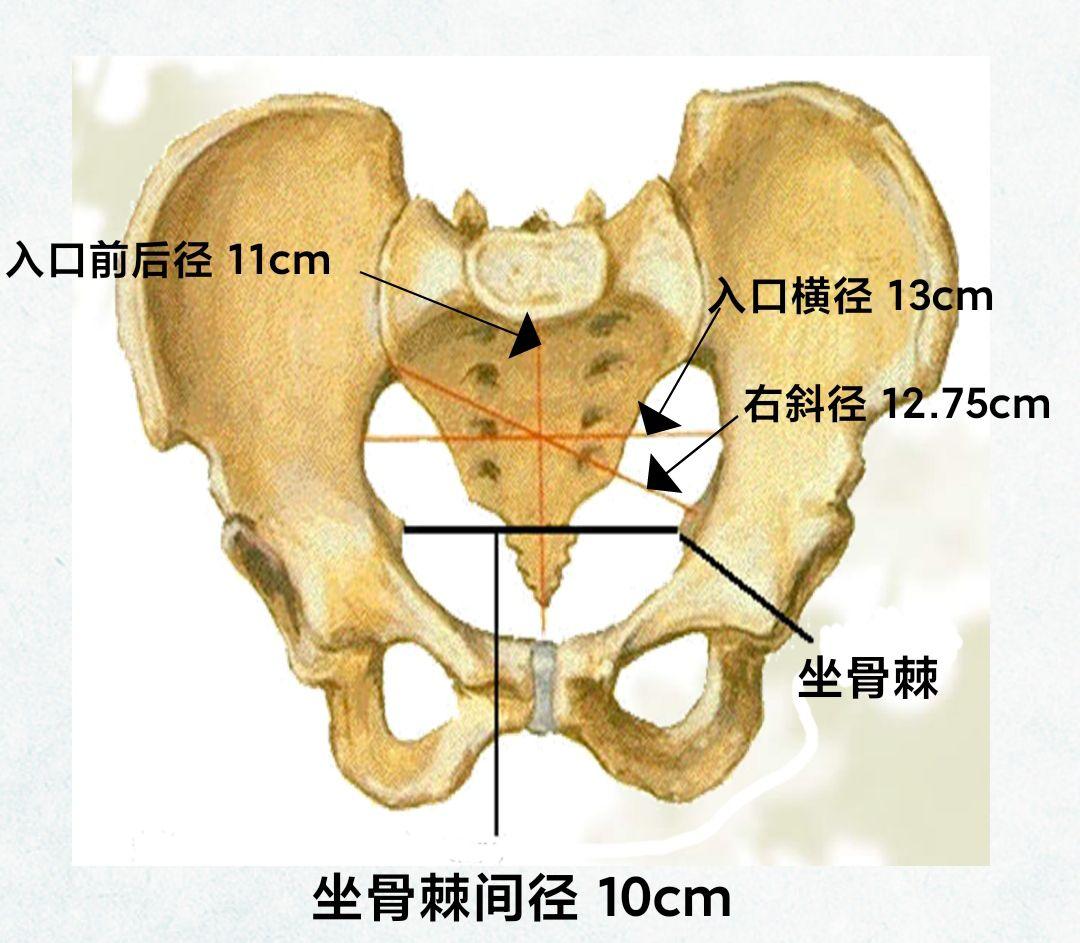 骨盆入口斜径,怎么区分左右斜径,哪条线是左斜径,哪条线是右斜径?