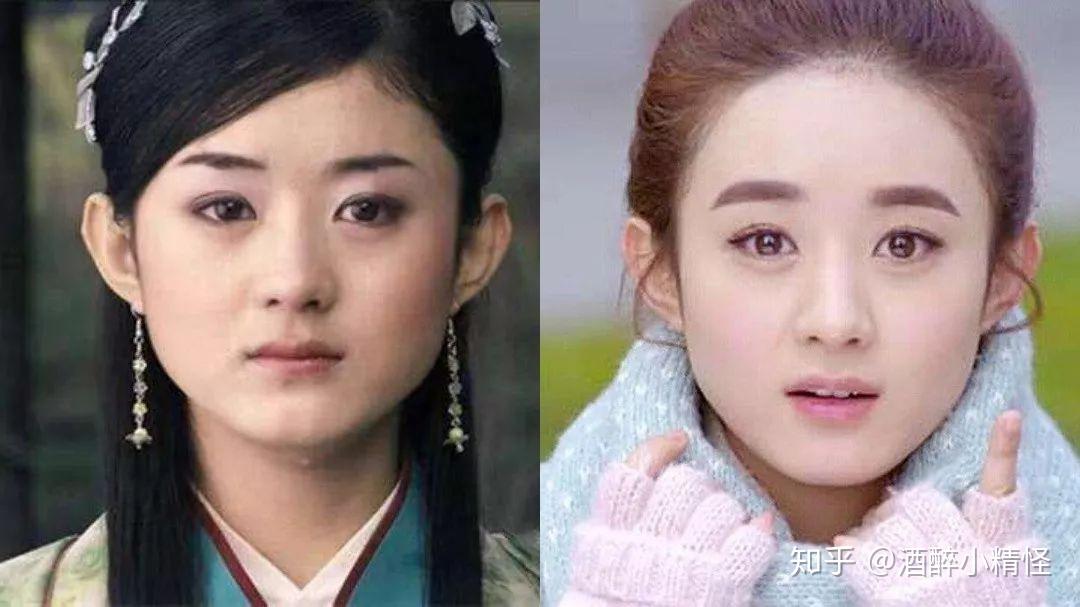 为什么几乎没有人按照赵丽颖的样子整容