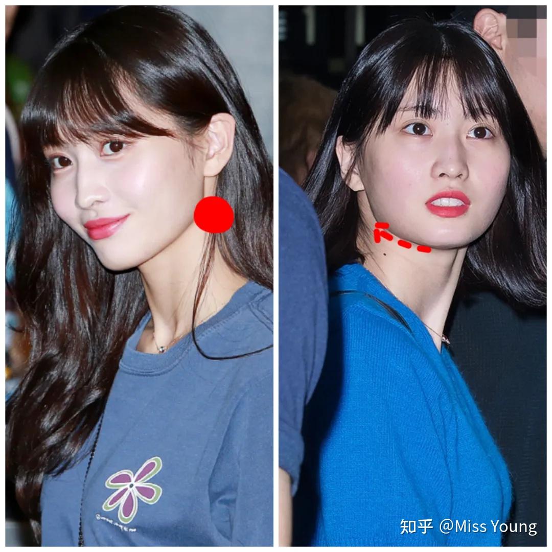 脖子短粗而且上斜方肌明显,有什么动作可以改善吗? - 知乎