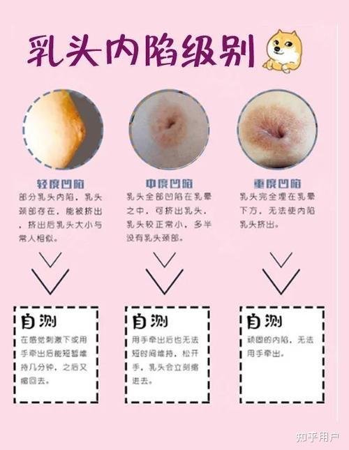 知乎