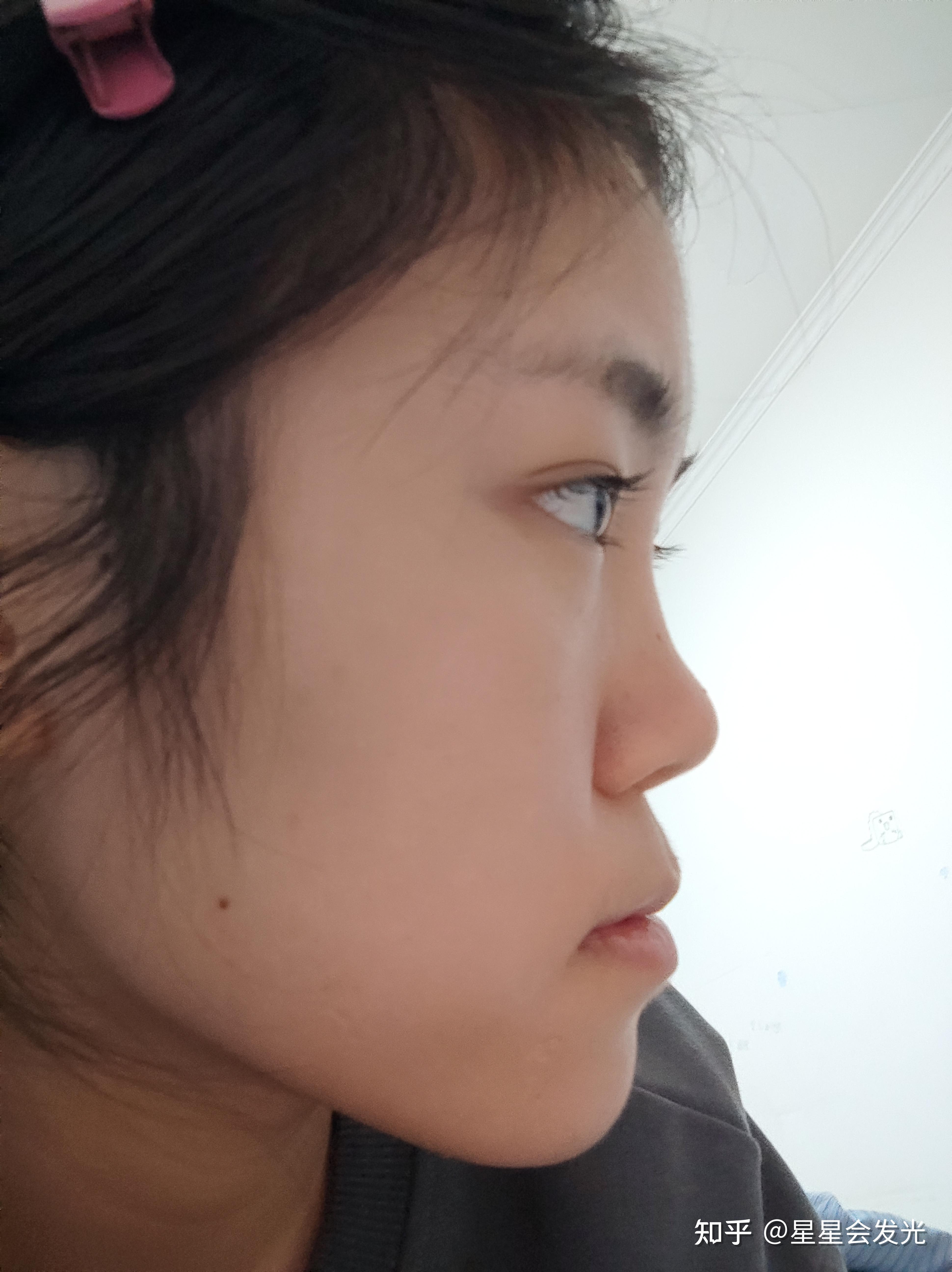 你见过鼻子塌,但是又好看的女生吗?