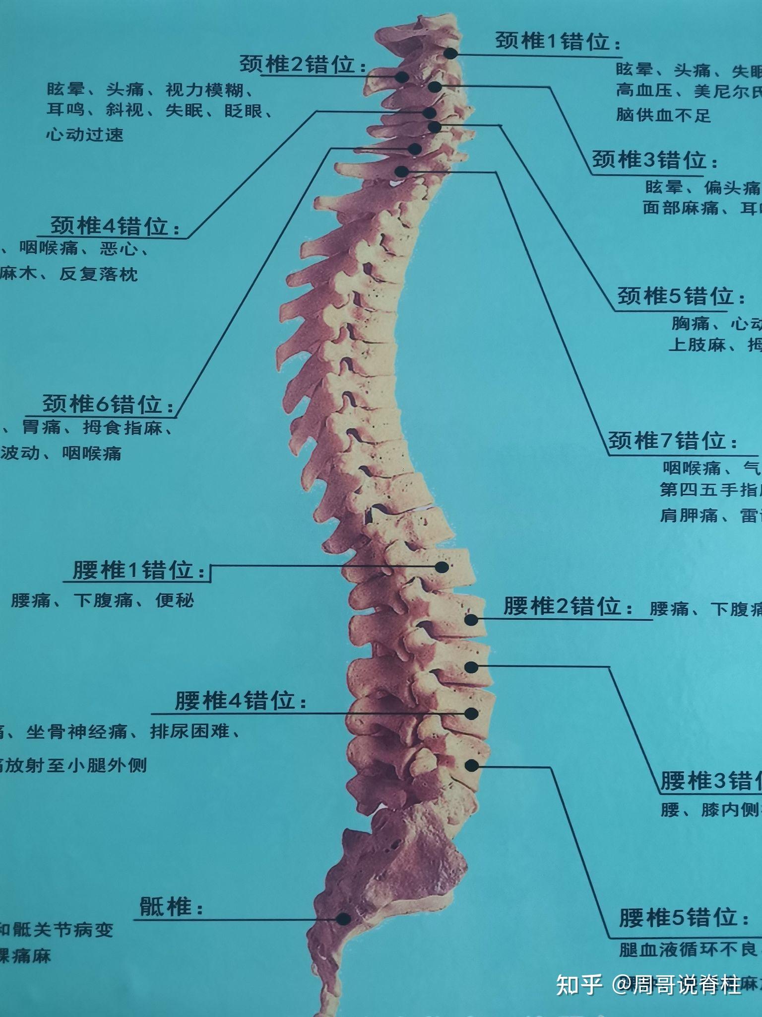 后背疼痛是什么原因引起的? - 知乎