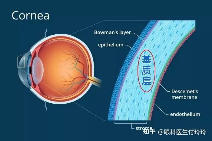 飞秒手术角膜消耗率怎么算？判断能否做近视手术的八大指标！