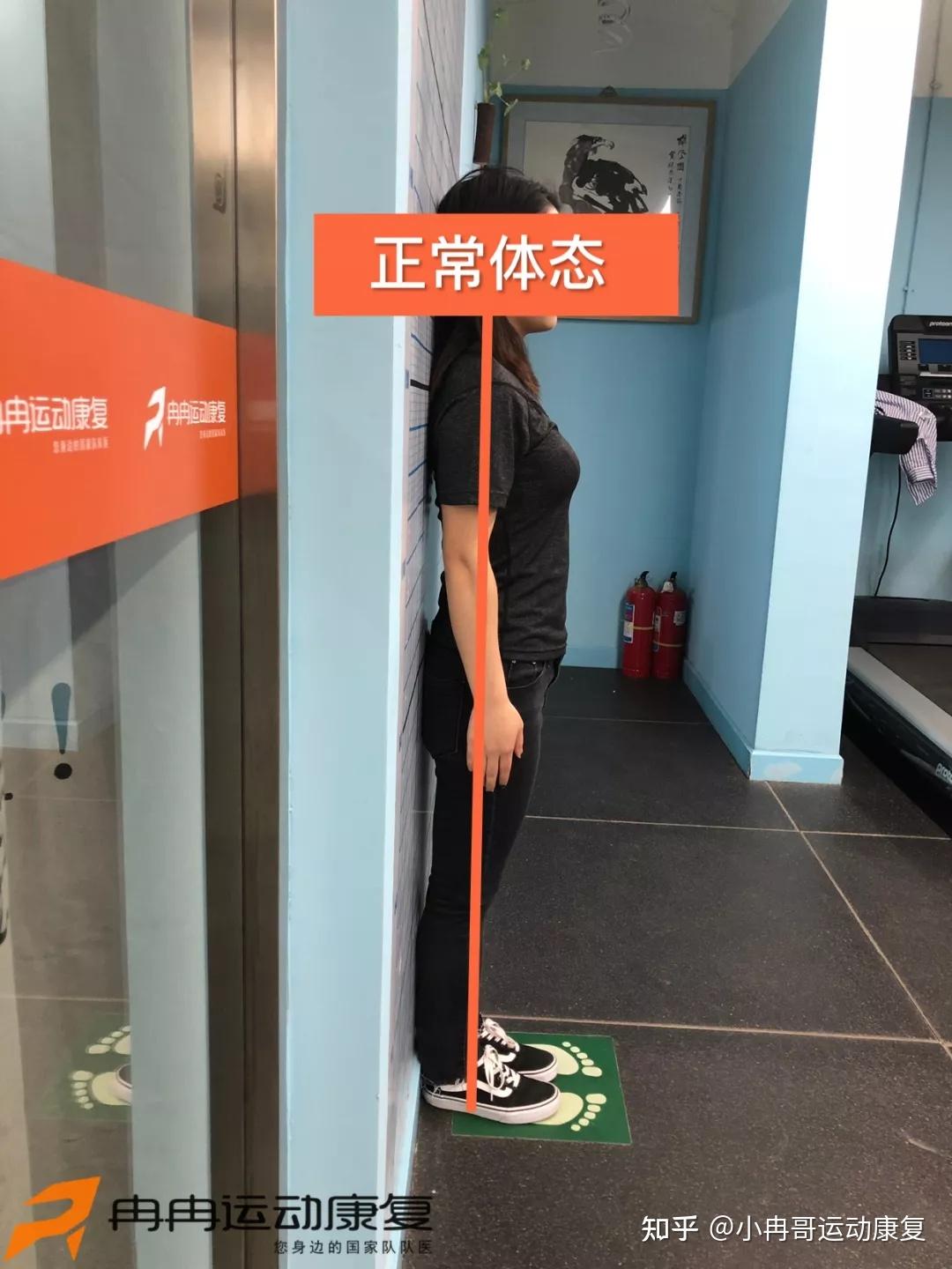 骨盆前倾是怎么形成的,能改善吗,能改善的话怎么改善? - 知乎