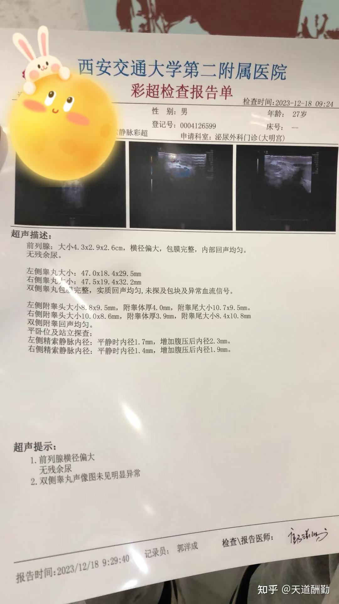 我的重度精索静脉曲张可以调理好吗?