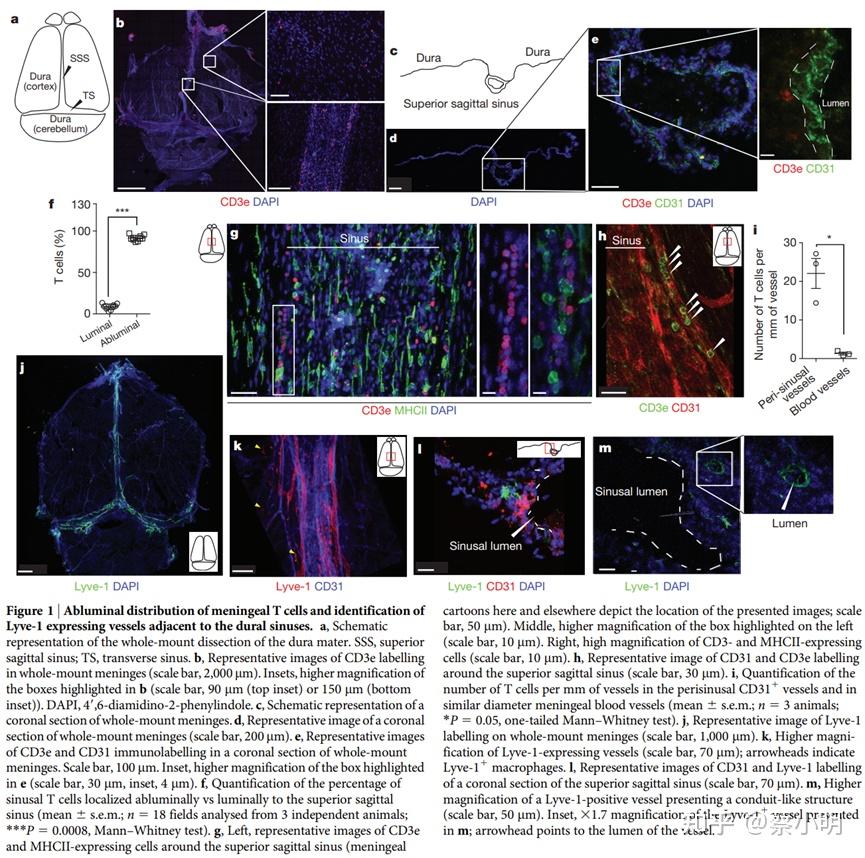 NID148_Structural and functional features of central nervous system ...