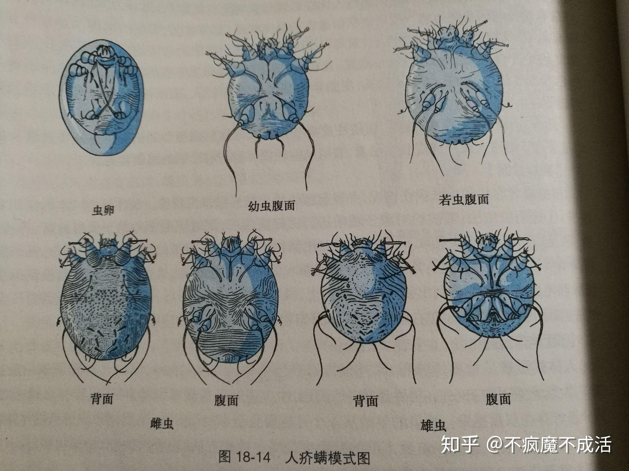 想请教各位这是疥螨还是尘螨