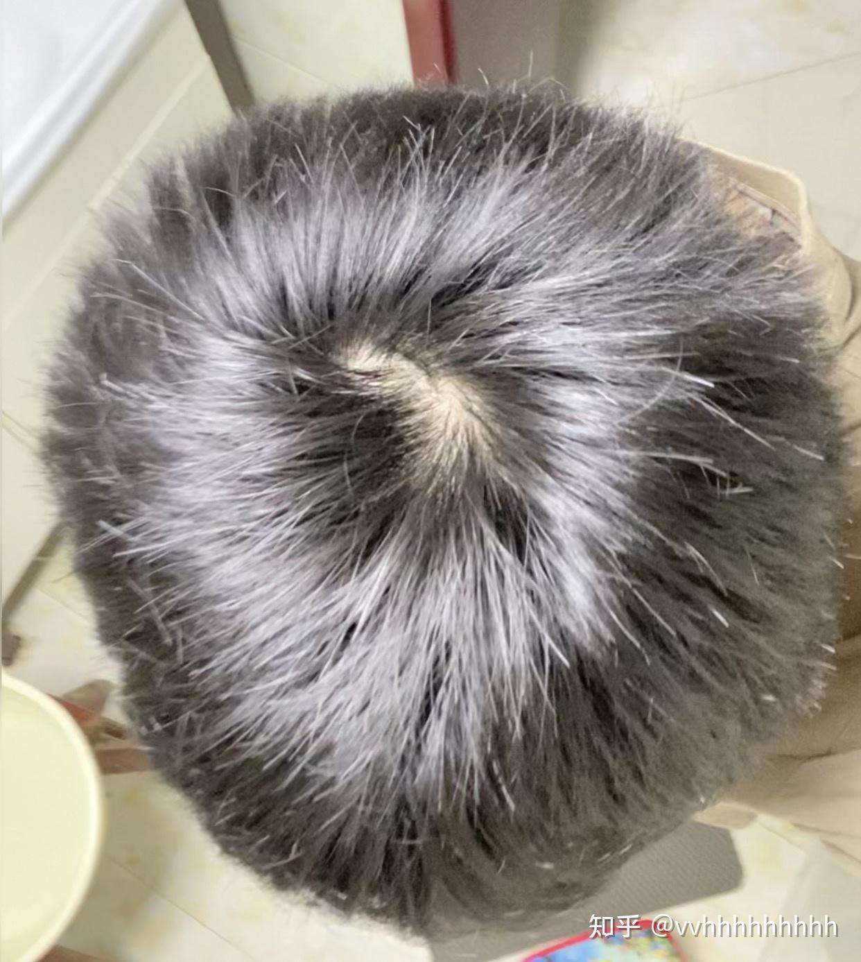 什么样子的发旋是正常的啊? - 知乎