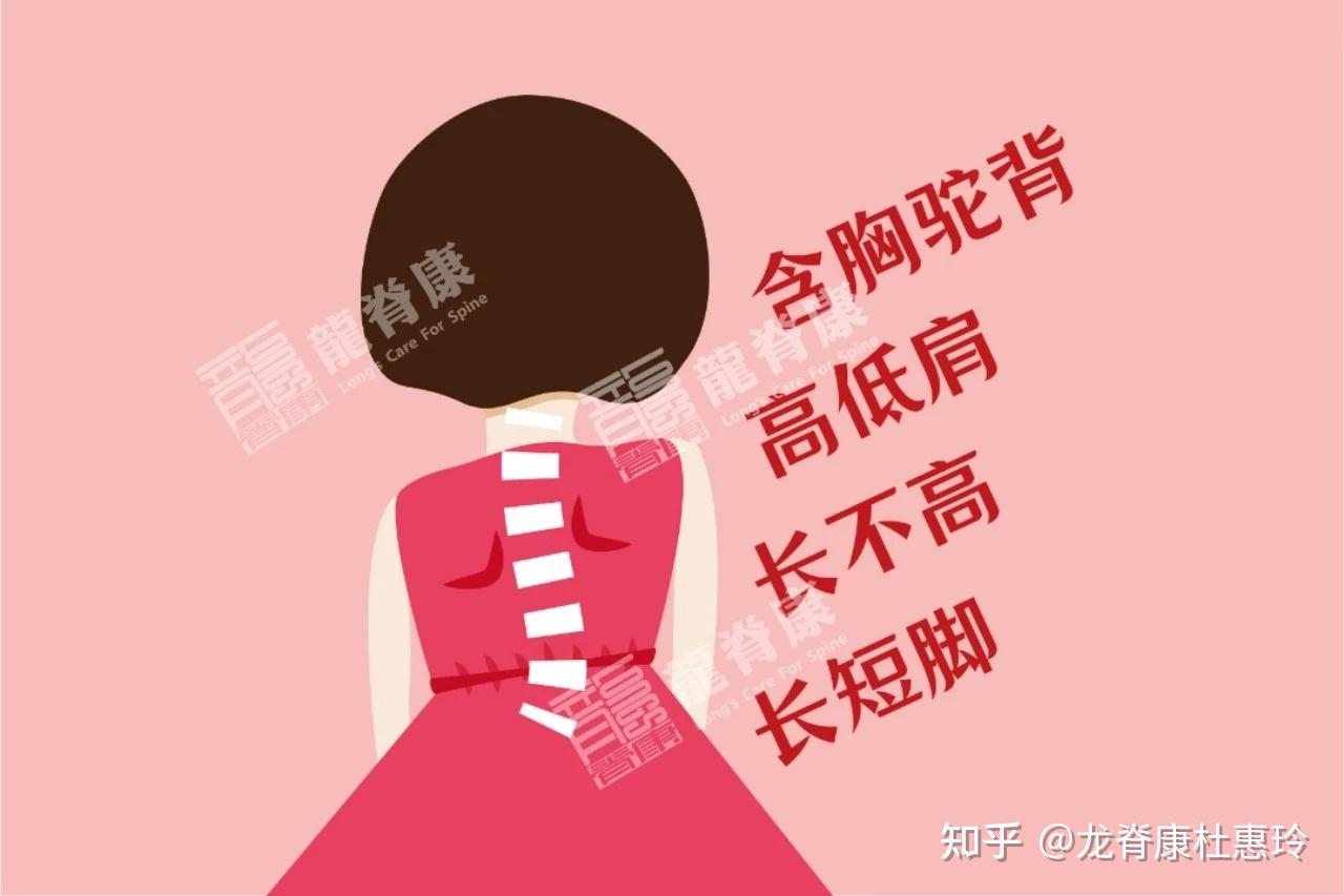 脊柱侧弯之施罗斯体操训练,如何正确呼吸和发力?详细告诉您 - 知乎