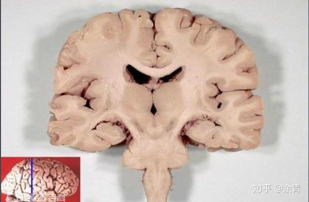 为什么会有灰质白质之分有神经元胞体聚集的地方不就有神经纤维也聚集