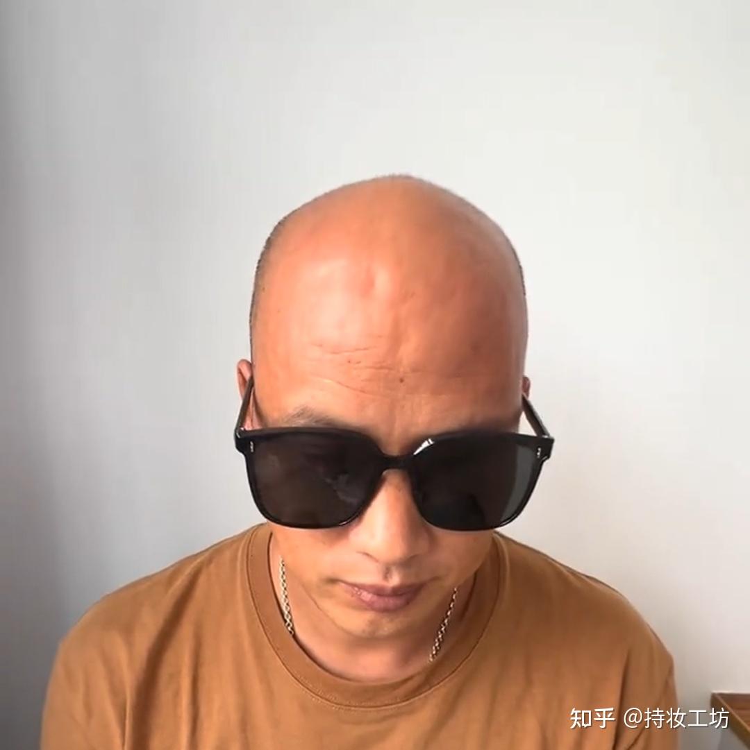 同样是留光头,纹发是怎么改善脱发形象的? - 知乎